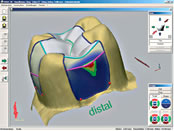 CEREC System