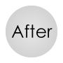 症例紹介after