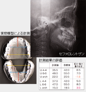 Zt@gQ摜Ǝ͌^ɂv\摜